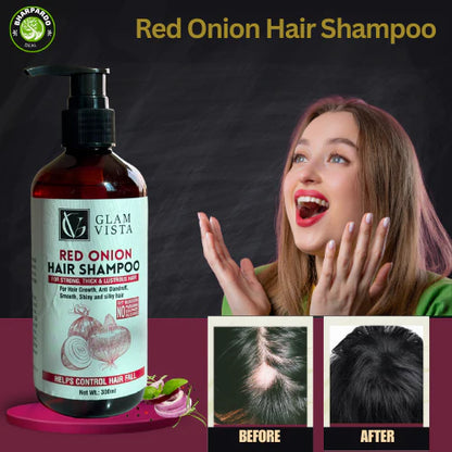 #1 Red Onion Hair Shampoo - अब त 100% कपाल झर्न रोक्छ