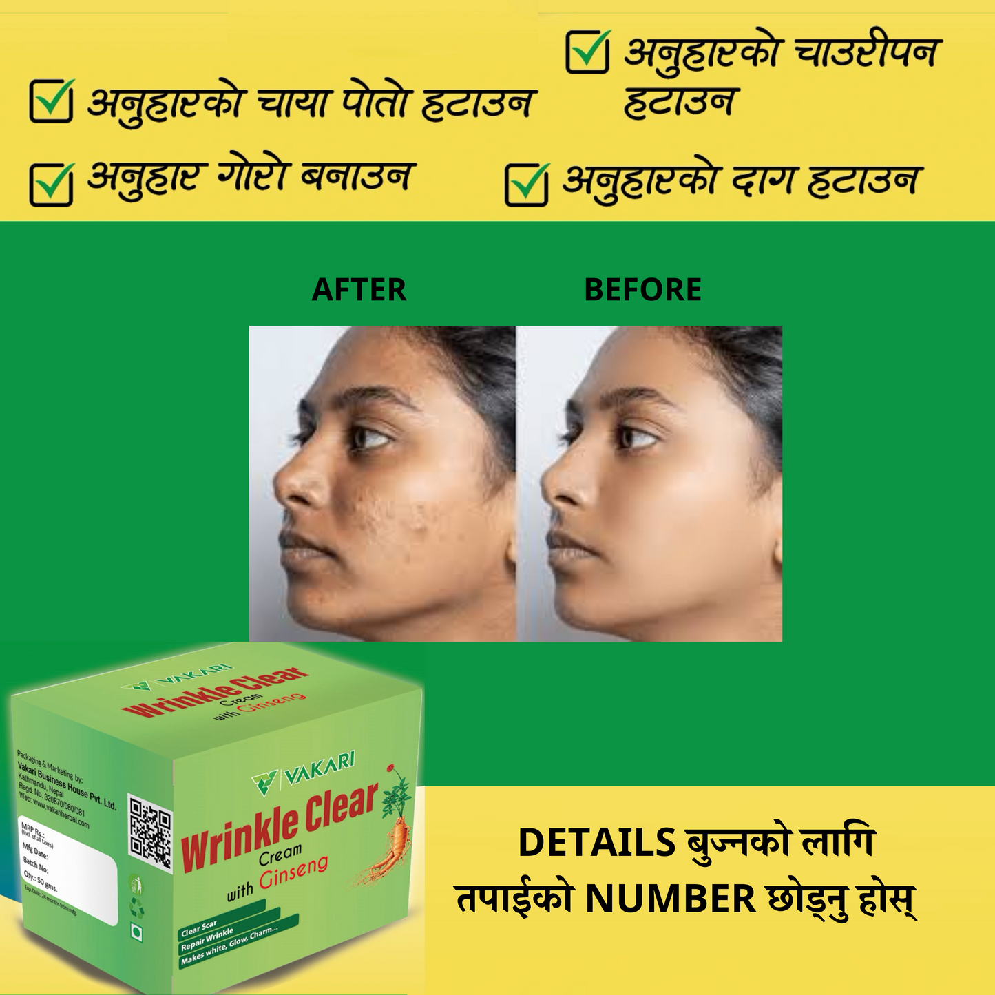 Wrinkle Clear Cream- छालाको जस्तो सुकै दाग, धब्बा हटाउने क्रिम [for Girls/Boys both]