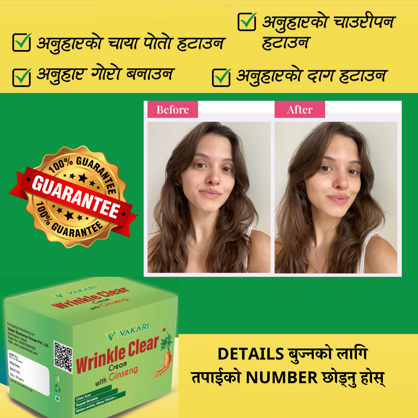 Wrinkle Clear Cream- छालाको जस्तो सुकै दाग, धब्बा हटाउने क्रिम [for Girls/Boys both]